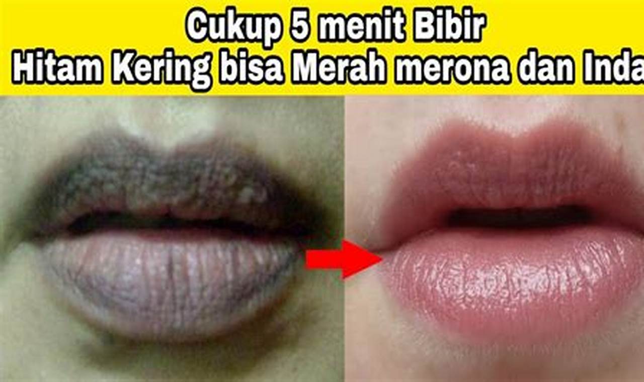 Cara Mengatasi Bibir Hitam Dengan Mudah Dan Efektif